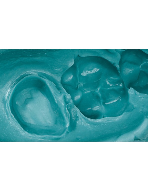 Honigum Pro Mono